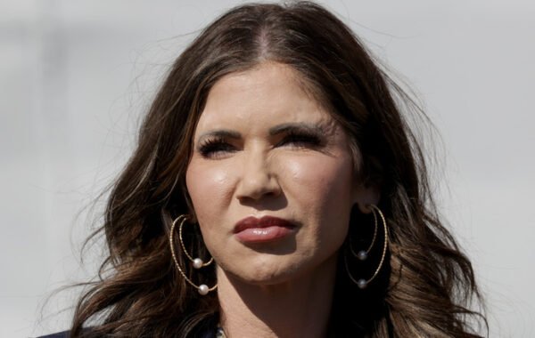 Kristi Noem Plastic Surgery