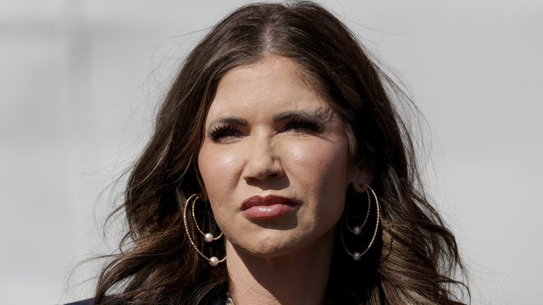 Kristi Noem Plastic Surgery